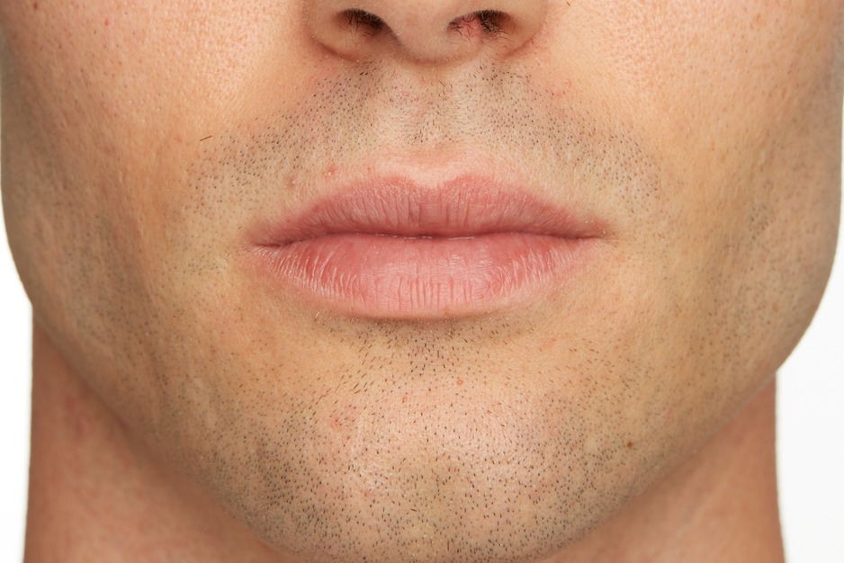 Image of a man lips before lips treatment
