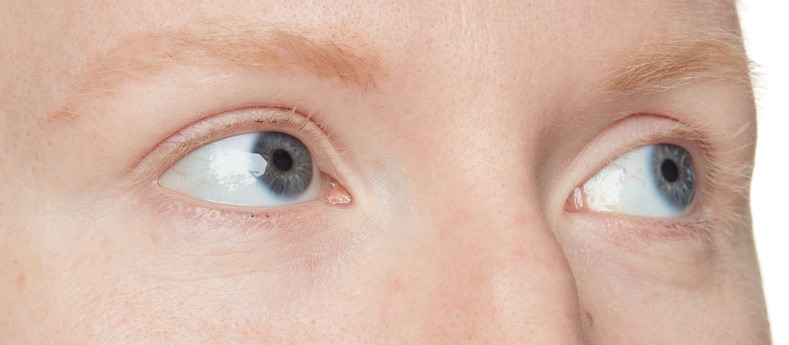 Image of woman eyes before mascara treatment